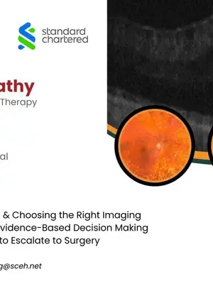 Diabetic Retinopathy: From Screening to Sight-Saving Therapy poster